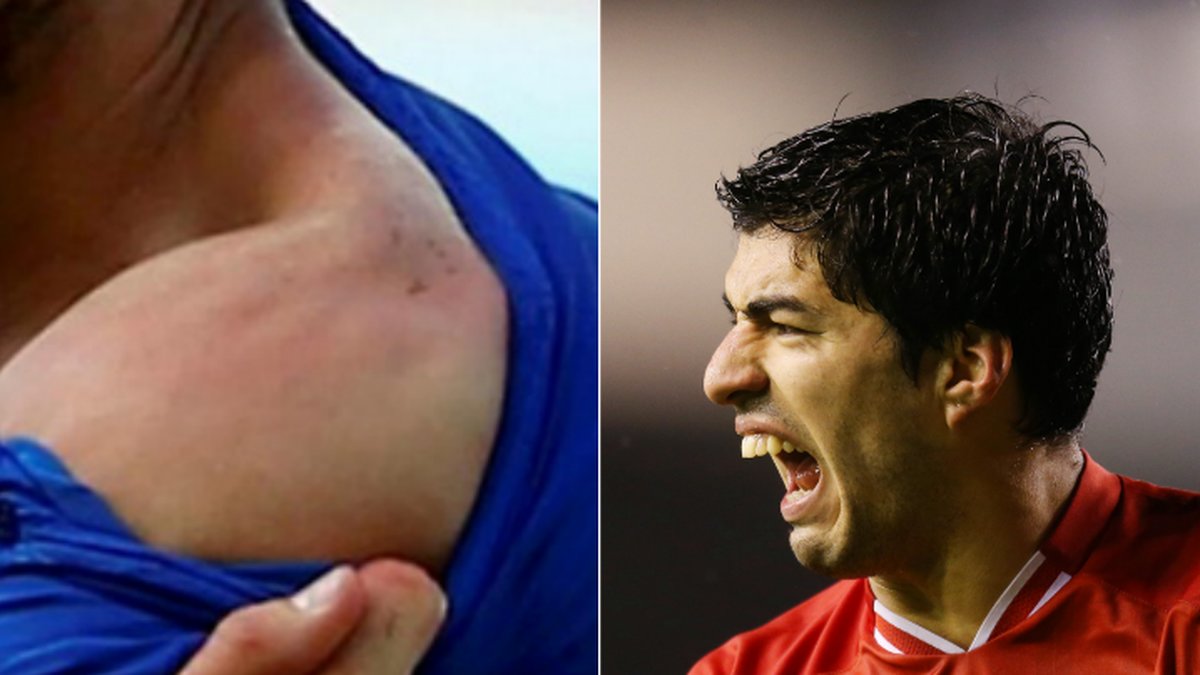 Bilderna visar tydligt att Luis Suarez bet Giorgio Chiellini under tisdagens match. 
